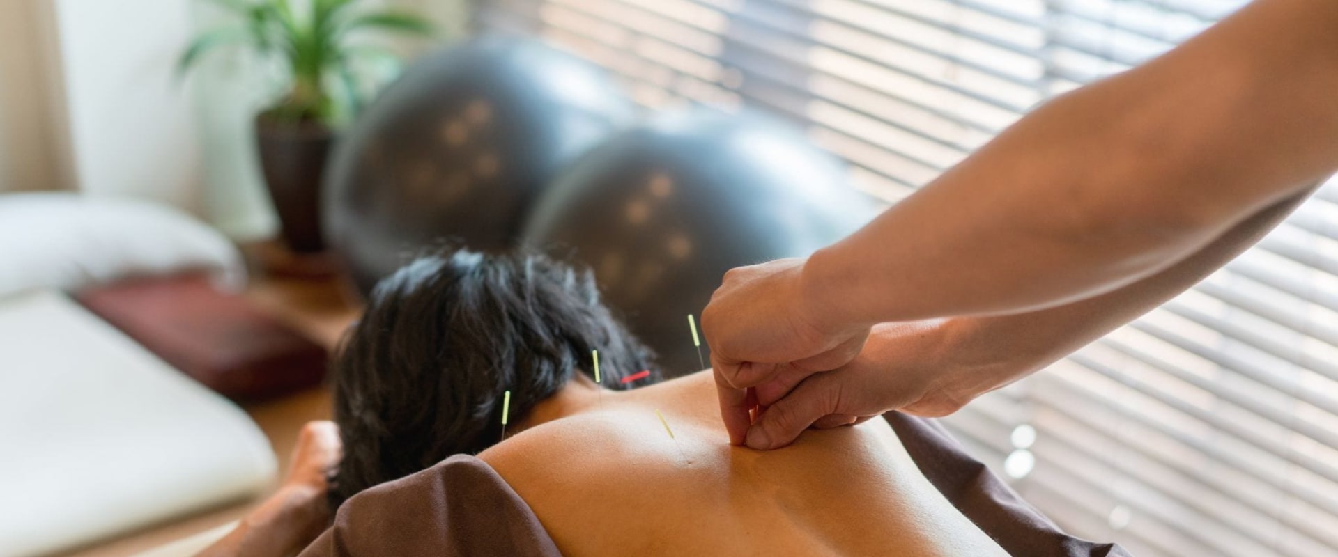 Everything You Need to Know About Electroacupuncture for Weight Loss