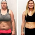 Polycystic Ovary Syndrome and Obesity: Causes and Effects