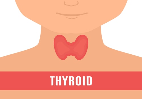 Hypothyroidism and Obesity: Causes, Symptoms, and Treatment