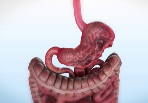 Understanding Endoscopic Sleeve Gastroplasty (ESG)