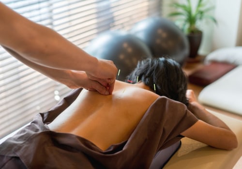 Everything You Need to Know About Electroacupuncture for Weight Loss